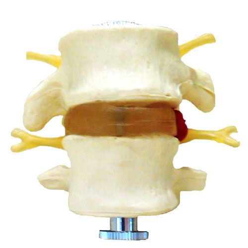 2 Vértebras lombares com discos
