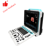 DW-P30 Ultrassom 4D/5D HIGH DEFINITION FULL HD 