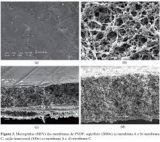 Membrana Filtrante